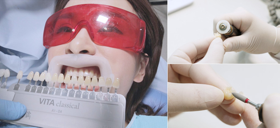 打磨、堆瓷、回切，到调色连续十几个小时的千锤百炼，产出一颗品相功能过关的麦芽品质义齿。